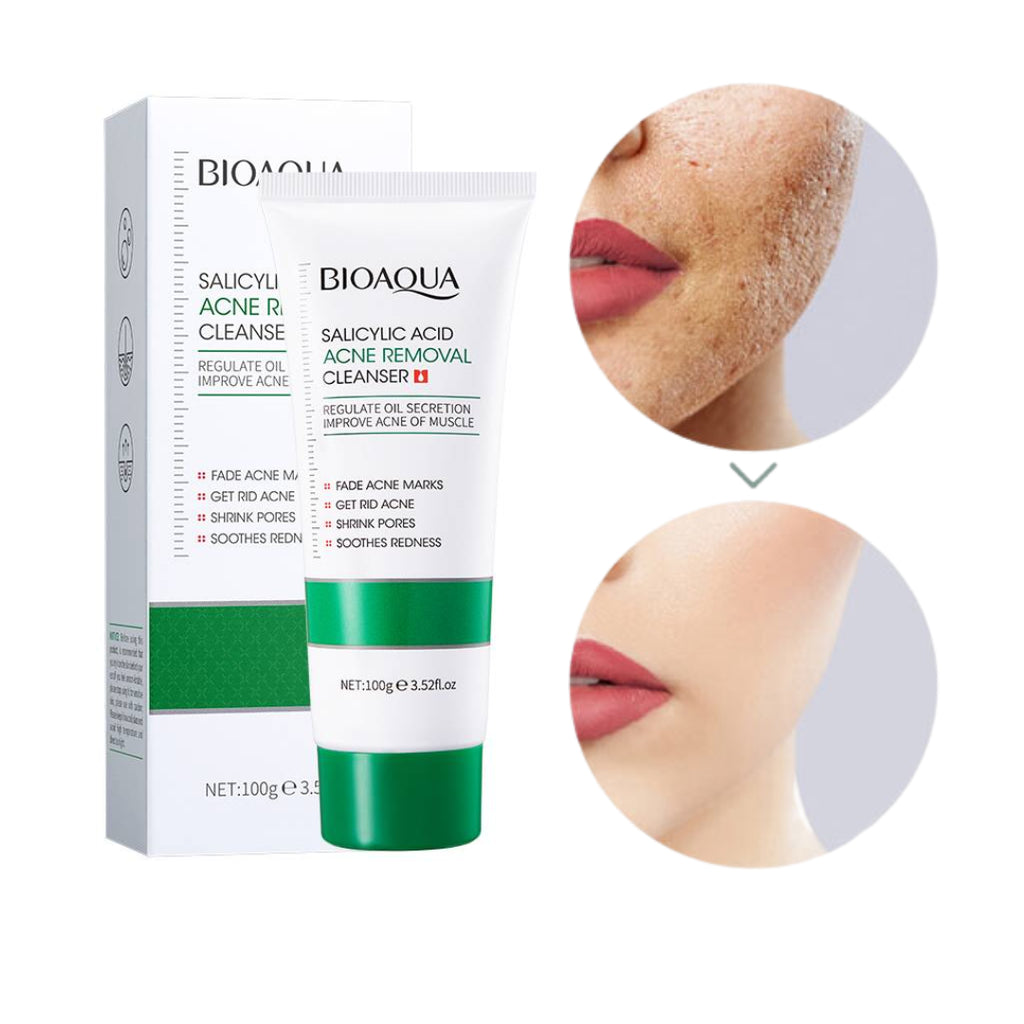 🚨-35% Jabón Facial Anti-Acné: Bioaqua Salicylic Acid Control  🔥ÚLTIMAS UNIDADES 🔥