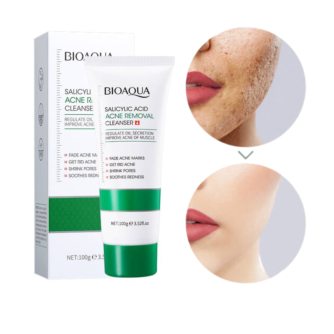 🚨-35% Jabón Facial Anti-Acné: Bioaqua Salicylic Acid Control  🔥ÚLTIMAS UNIDADES 🔥